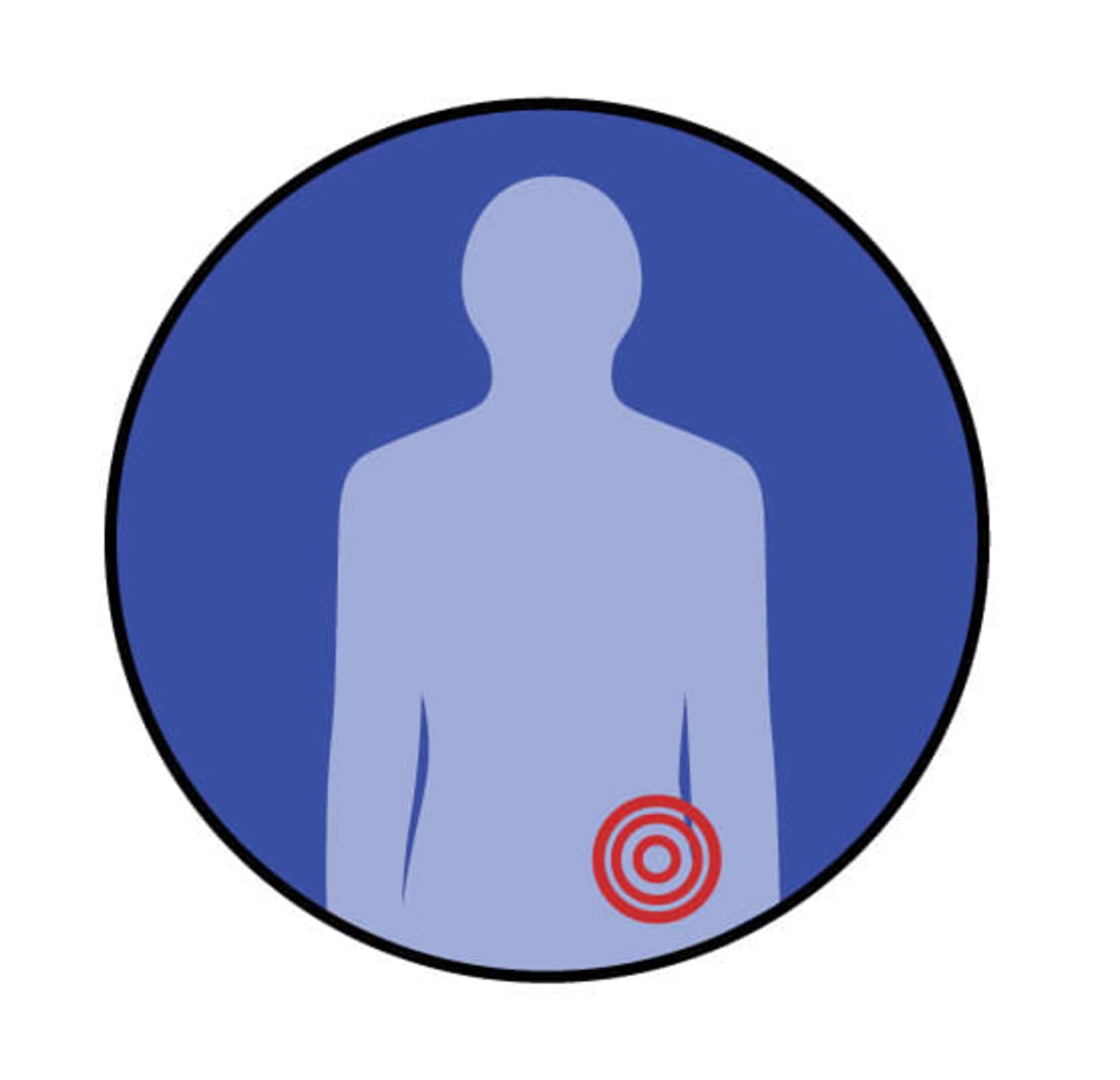 Hip pain location graphic image