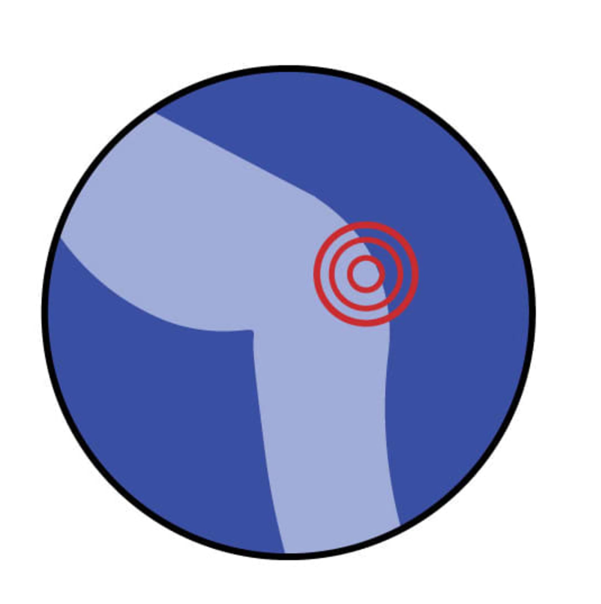 Knee pain location graphic image