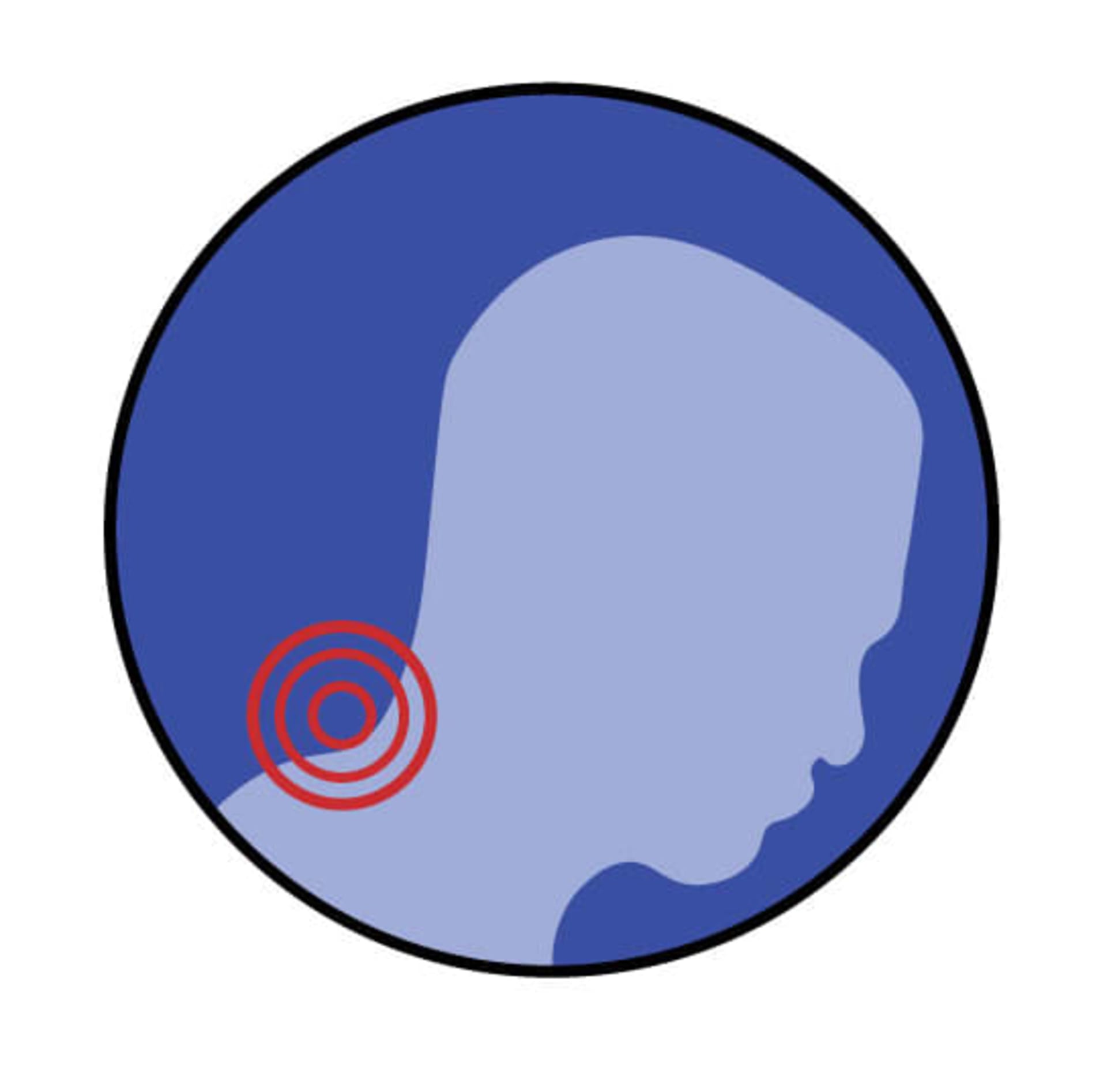 Neck Pain location graphic image