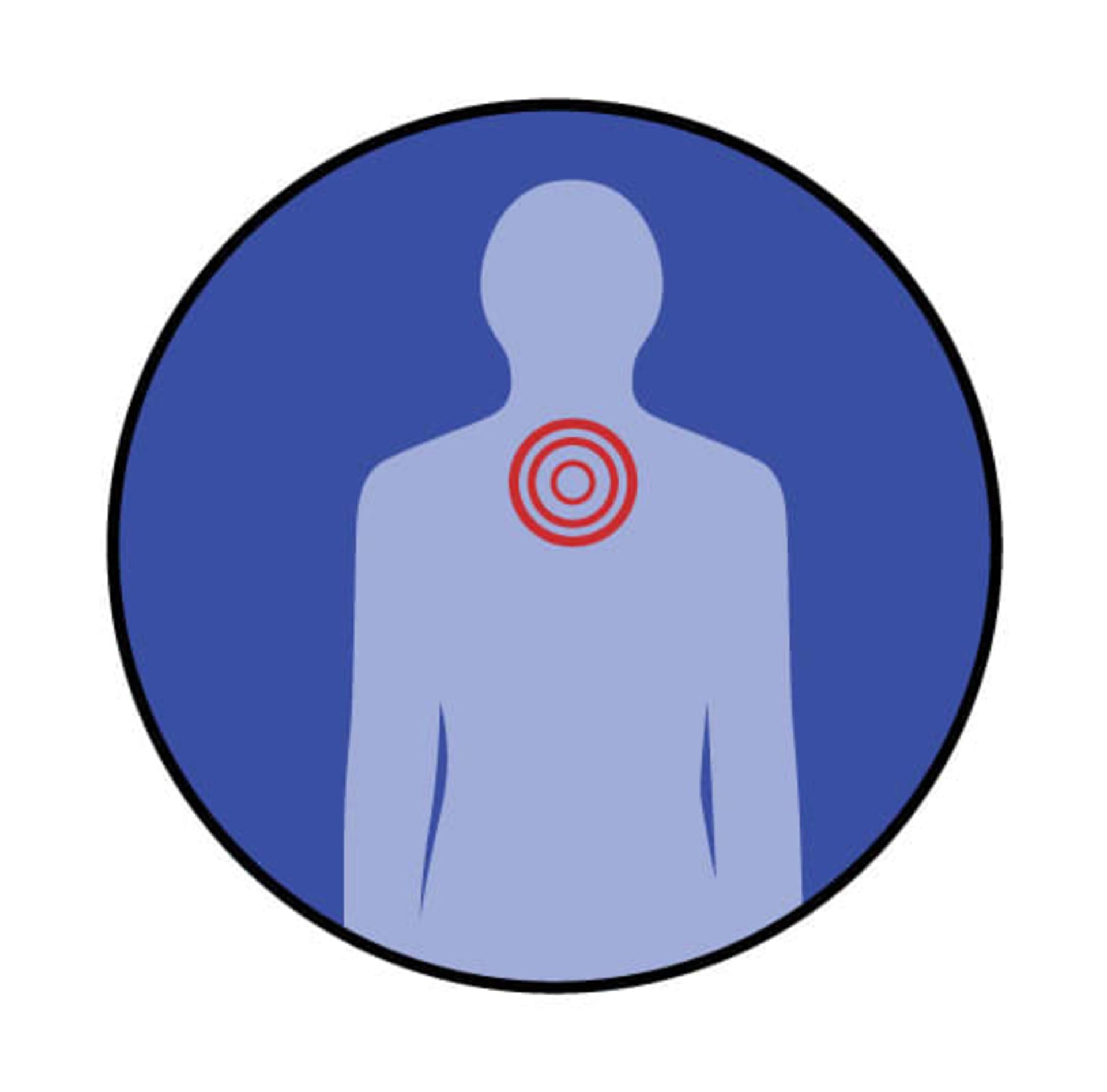 Upper back pain location graphic image
