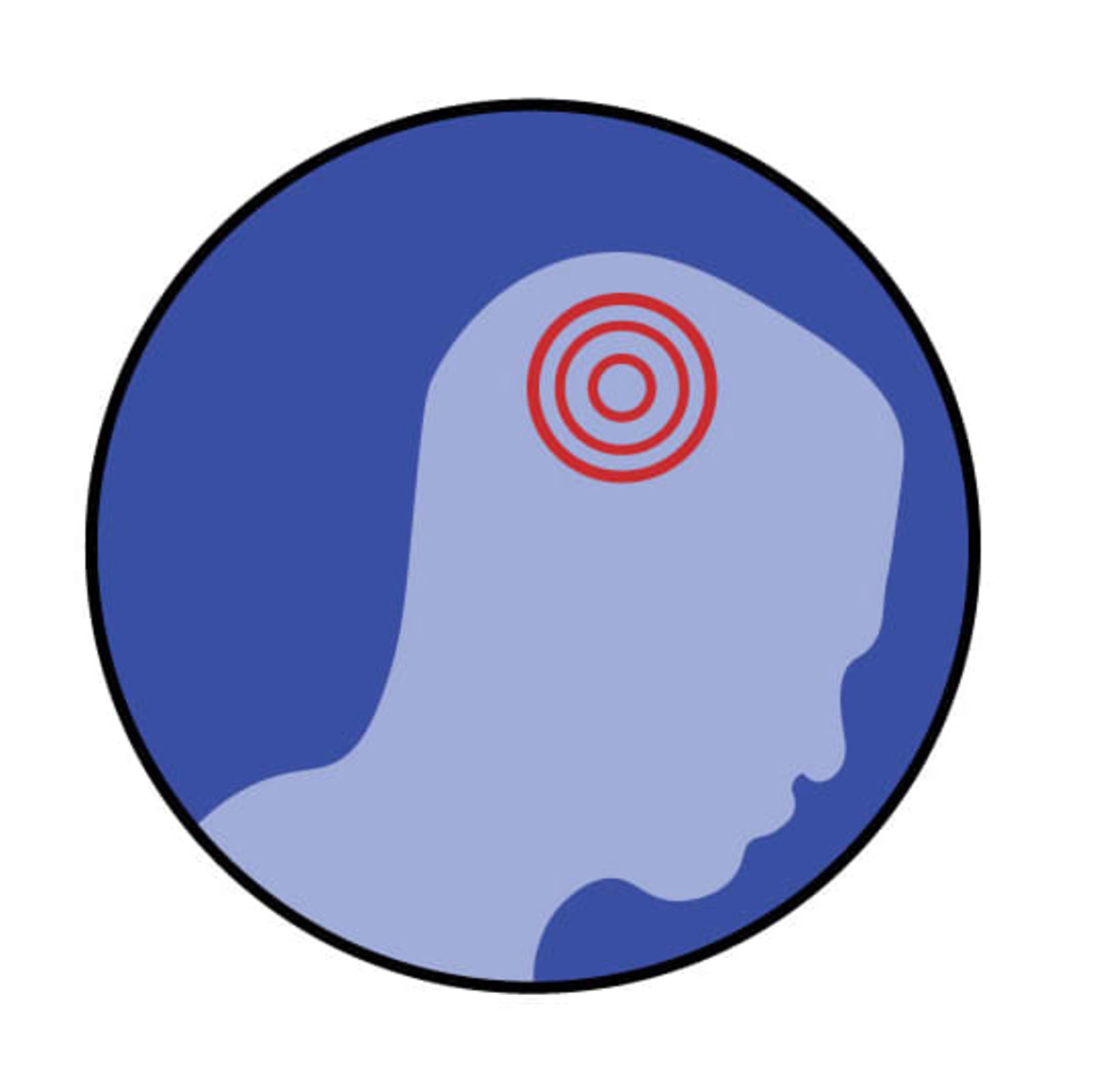 Headache pain location graphic image